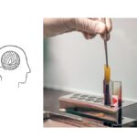 Nuevas estrategias para tratar enfermedades neurológicas explorando el papel del sistema inmunitario y la fuga de sangre en el cerebro